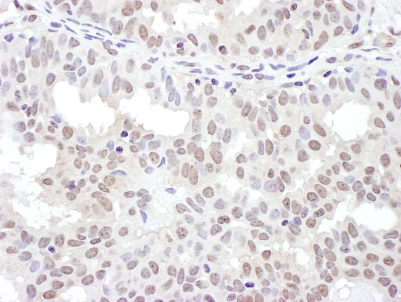 Immunohistochemistry (Formalin/PFA-fixed paraffin-embedded sections) - Anti-NKRF antibody (AB168829)