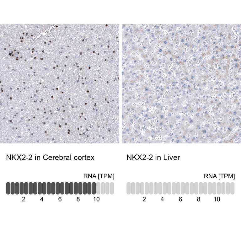 Immunohistochemistry (Formalin/PFA-fixed paraffin-embedded sections) - Anti-NKX2-2 Antibody [CL11380] (AB327133)