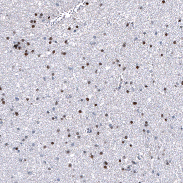 Immunohistochemistry (Formalin/PFA-fixed paraffin-embedded sections) - Anti-NKX2-2 Antibody [CL11380] (AB327133)