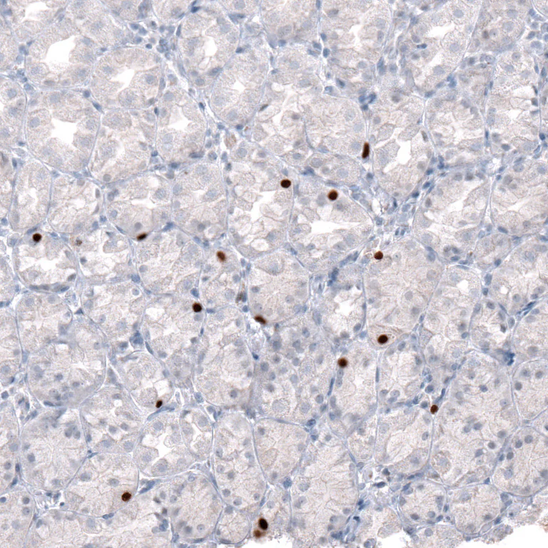 Immunohistochemistry (Formalin/PFA-fixed paraffin-embedded sections) - Anti-NKX2-2 Antibody [CL11380] (AB327133)