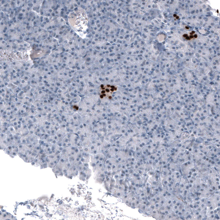 Immunohistochemistry (Formalin/PFA-fixed paraffin-embedded sections) - Anti-NKX2-2 Antibody [CL11380] (AB327133)