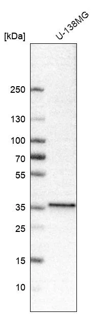 Western blot - Anti-NKX2-2 Antibody [CL11380] (AB327133)