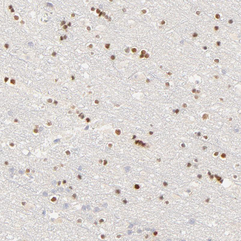 Immunohistochemistry (Formalin/PFA-fixed paraffin-embedded sections) - Anti-Nkx2.2 antibody (AB244270), expandable thumbnail