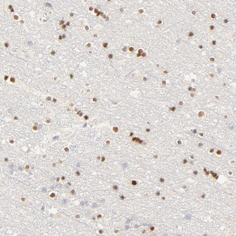 Immunohistochemistry (Formalin/PFA-fixed paraffin-embedded sections) - Anti-Nkx2.2 antibody (AB244270)