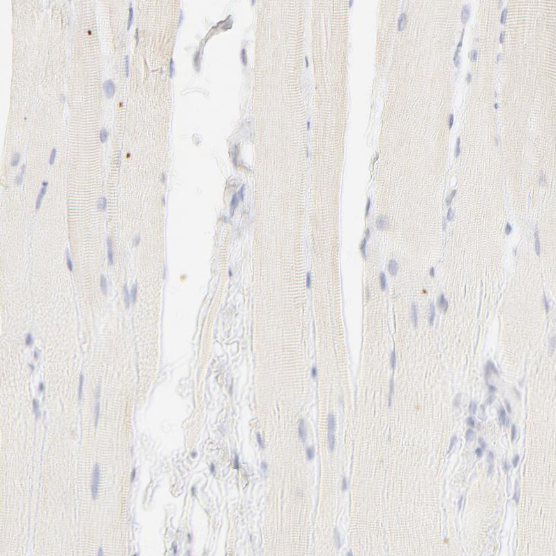 Immunohistochemistry (Formalin/PFA-fixed paraffin-embedded sections) - Anti-Nkx2.2 antibody (AB244270), expandable thumbnail