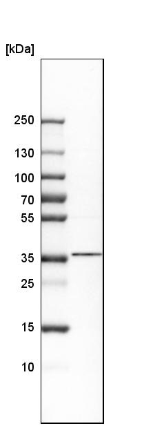 Western blot - Anti-Nkx2.2 antibody (AB244270), expandable thumbnail