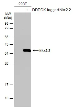 Western blot - Anti-Nkx2.2 antibody (AB272915)
