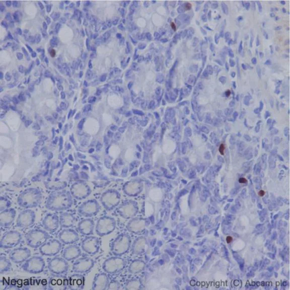 Immunohistochemistry (Formalin/PFA-fixed paraffin-embedded sections) - Anti-Nkx2.2 antibody [EPR14638] - N-terminal (AB191077)