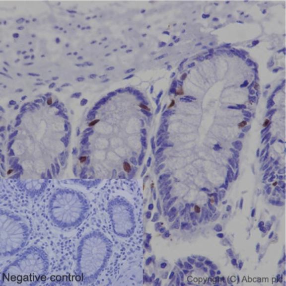 Immunohistochemistry (Formalin/PFA-fixed paraffin-embedded sections) - Anti-Nkx2.2 antibody [EPR14638] - N-terminal (AB191077)