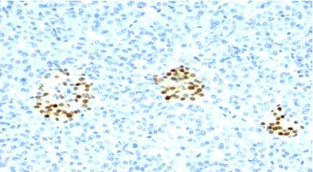Immunohistochemistry (Formalin/PFA-fixed paraffin-embedded sections) - Anti-Nkx2.2 antibody [NX2/294] (AB187375)