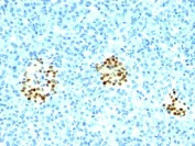 Immunohistochemistry (Formalin/PFA-fixed paraffin-embedded sections) - Anti-Nkx2.2 antibody [NX2/294] - BSA and Azide free (AB212686)