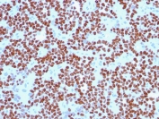 Immunohistochemistry (Formalin/PFA-fixed paraffin-embedded sections) - Anti-Nkx2.2 antibody [NX2/294] - BSA and Azide free (AB212686)