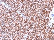 Immunohistochemistry (Formalin/PFA-fixed paraffin-embedded sections) - Anti-Nkx2.2 antibody [rNX2/294] (AB218470)