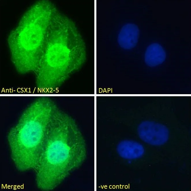 Immunocytochemistry - Anti-Nkx2.5 antibody (AB106923)