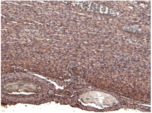 Immunohistochemistry (Formalin/PFA-fixed paraffin-embedded sections) - Anti-Nkx2.5 antibody (AB106923)