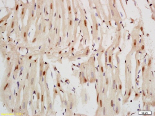 Immunohistochemistry (Formalin/PFA-fixed paraffin-embedded sections) - Anti-Nkx2.5 antibody (AB214296)