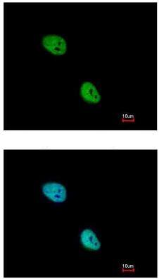 Immunocytochemistry/ Immunofluorescence - Anti-Nkx2.5 antibody (AB97355), expandable thumbnail
