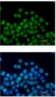 Immunocytochemistry/ Immunofluorescence - Anti-Nkx2.5 antibody (AB97355), expandable thumbnail