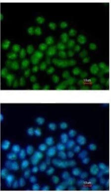 Immunocytochemistry/ Immunofluorescence - Anti-Nkx2.5 antibody (AB97355)
