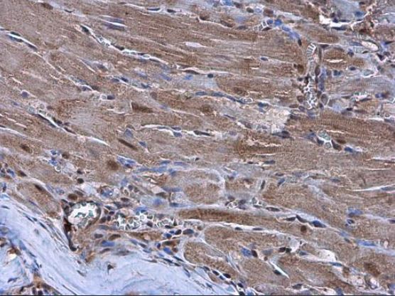 Immunohistochemistry (Formalin/PFA-fixed paraffin-embedded sections) - Anti-Nkx2.5 antibody (AB97355), expandable thumbnail