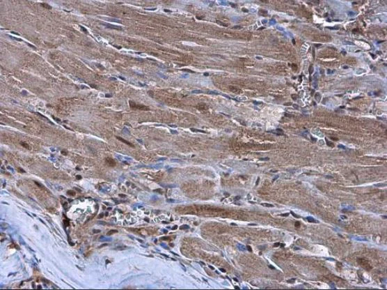 Immunohistochemistry (Formalin/PFA-fixed paraffin-embedded sections) - Anti-Nkx2.5 antibody (AB97355)