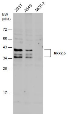 Western blot - Anti-Nkx2.5 antibody (AB97355), expandable thumbnail