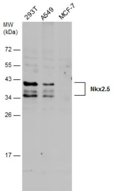 Western blot - Anti-Nkx2.5 antibody (AB97355)