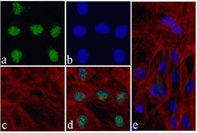 Immunocytochemistry/ Immunofluorescence - Anti-Nkx2.5 antibody [RP23040095] (AB313431)