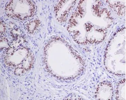 Immunohistochemistry (Formalin/PFA-fixed paraffin-embedded sections) - Anti-Nkx3.1 antibody [EPR14970] (AB186413)