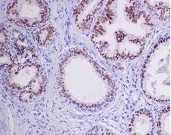 Immunohistochemistry (Formalin/PFA-fixed paraffin-embedded sections) - Anti-Nkx3.1 antibody [EPR14970] - BSA and Azide free (AB250875), expandable thumbnail