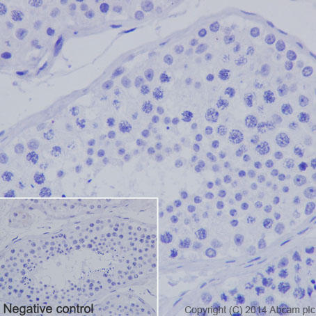 Immunohistochemistry (Formalin/PFA-fixed paraffin-embedded sections) - Anti-Nkx3.1 antibody [EPR16653] - BSA and Azide free (AB251217), expandable thumbnail