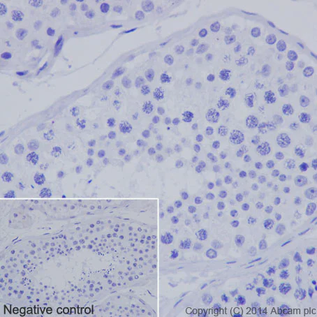 Immunohistochemistry (Formalin/PFA-fixed paraffin-embedded sections) - Anti-Nkx3.1 antibody [EPR16653] - BSA and Azide free (AB251217)