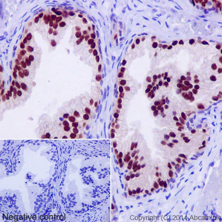 Immunohistochemistry (Formalin/PFA-fixed paraffin-embedded sections) - Anti-Nkx3.1 antibody [EPR16653] - BSA and Azide free (AB251217)