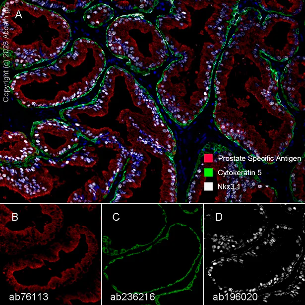 Multiplex immunohistochemistry - Anti-Nkx3.1 antibody [EPR16653] - BSA and Azide free (AB251217)