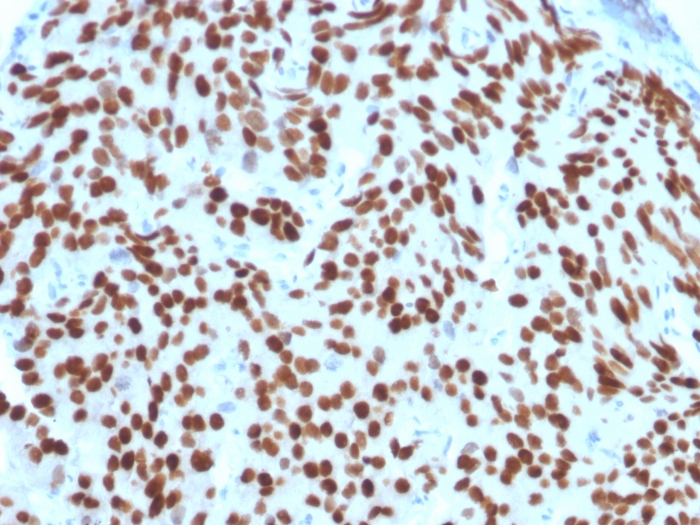 Immunohistochemistry (Formalin/PFA-fixed paraffin-embedded sections) - Anti-Nkx3.1 antibody [NKX3.1/2576] (AB257308)