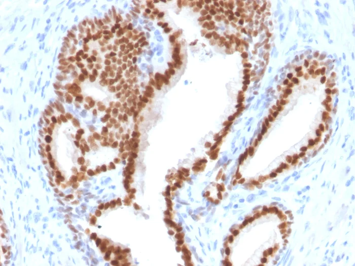 Immunohistochemistry (Formalin/PFA-fixed paraffin-embedded sections) - Anti-Nkx3.1 antibody [NKX3.1/2576] - BSA and Azide free (AB257325)