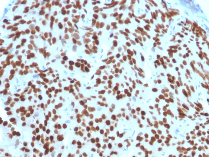Immunohistochemistry (Formalin/PFA-fixed paraffin-embedded sections) - Anti-Nkx3.1 antibody [NKX3.1/2576] - BSA and Azide free (AB257325)