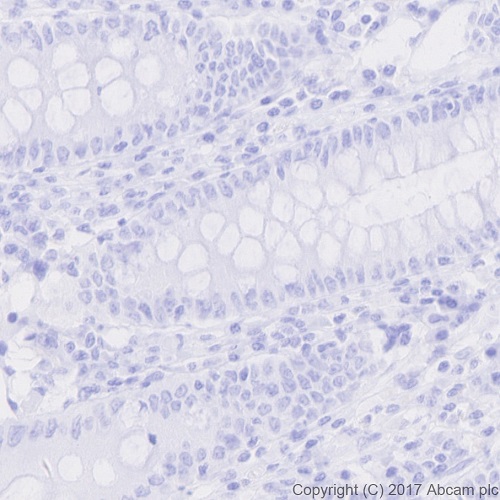 Immunohistochemistry (Formalin/PFA-fixed paraffin-embedded sections) - Anti-nkx6.1 antibody [EPR20328] (AB221544), expandable thumbnail