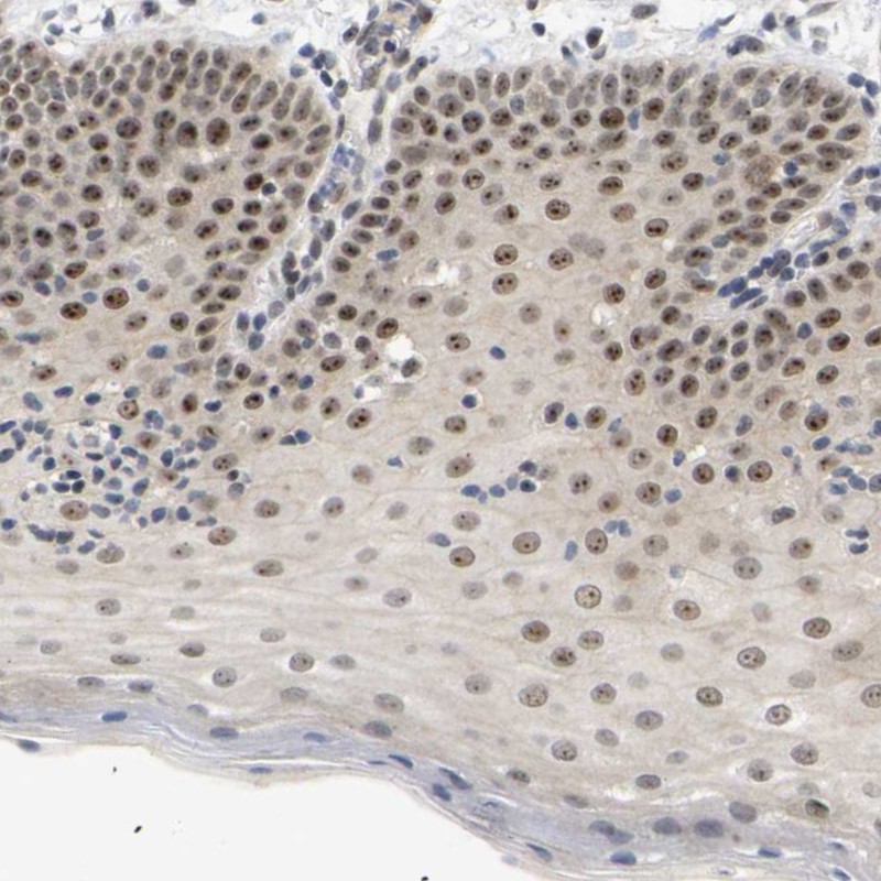 Immunohistochemistry (Formalin/PFA-fixed paraffin-embedded sections) - Anti-NLE1/nle antibody (AB254731)