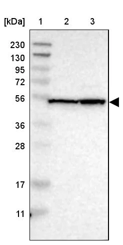 Western blot - Anti-NLE1/nle antibody (AB254731)