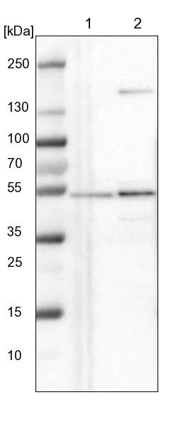 Western blot - Anti-NLE1/nle antibody (AB254731)