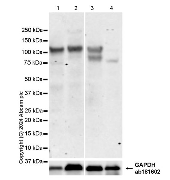 Western blot - Anti-NLGN4 antibody [EPR26331-43] (AB316740)