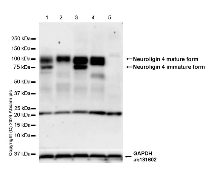 Western blot - Anti-NLGN4 antibody [EPR26331-43] - BSA and Azide free (AB316741)