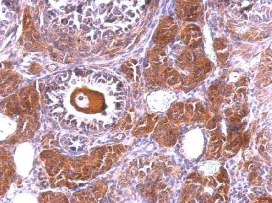 Immunohistochemistry (Formalin/PFA-fixed paraffin-embedded sections) - Anti-NLK antibody (AB97642)