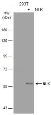 Western blot - Anti-NLK antibody (AB97642)