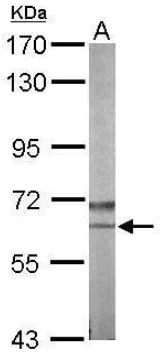Western blot - Anti-NLK antibody (AB97642)