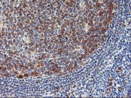 Immunohistochemistry (Formalin/PFA-fixed paraffin-embedded sections) - Anti-NLN antibody [OTI1D6] (AB119802)