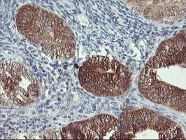 Immunohistochemistry (Formalin/PFA-fixed paraffin-embedded sections) - Anti-NLN antibody [OTI1D6] (AB119802)