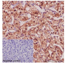 Immunohistochemistry (Formalin/PFA-fixed paraffin-embedded sections) - Anti-NLP1 antibody [EPR16545] (AB192609)