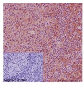 Immunohistochemistry (Formalin/PFA-fixed paraffin-embedded sections) - Anti-NLP1 antibody [EPR16545] - BSA and Azide free (AB251143)